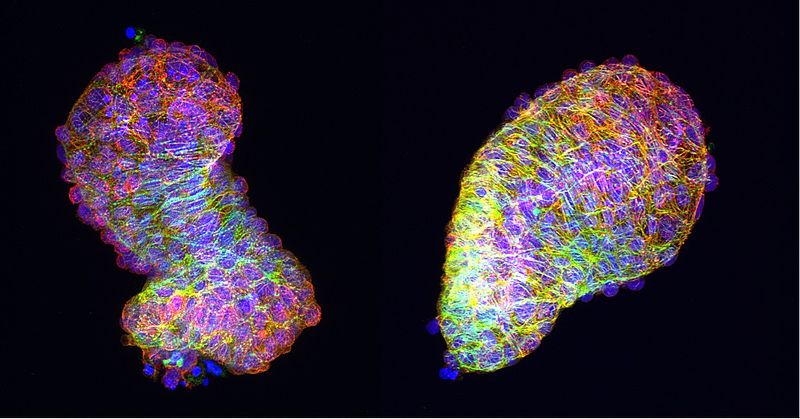 Explantierte Zebrafisch-Herzen bilden ihre Form eigenständig in der Petrischale, (links) – nicht aber, wenn der Frizzled-7a-Faktor des PCP-Signalweges fehlt: Das Herz bleibt ein Schlauch (rechts).  © Anne M. Merks, MDC