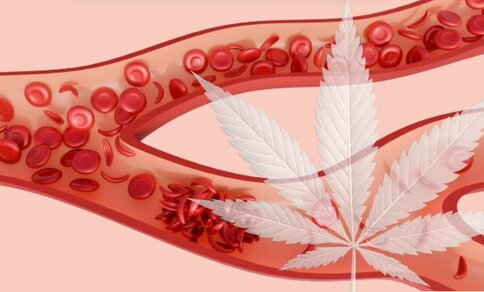 llustration eines Blutgefäßes mit fließenden roten Blutkörperchen und Ablagerungen an der Gefäßwand, überlagert von einem großen, halbtransparenten Cannabisblatt.