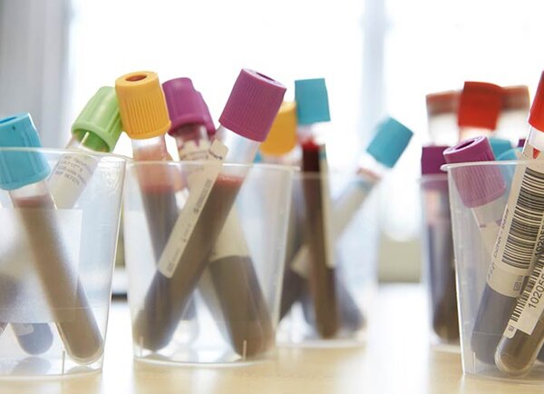 Biobanking