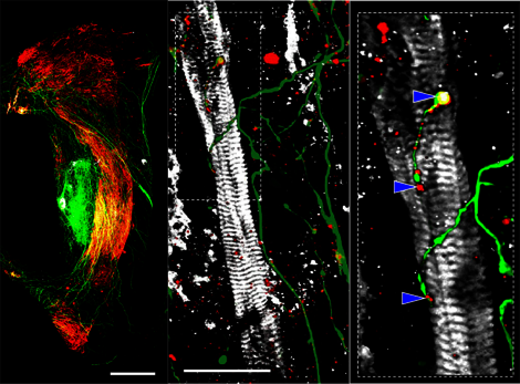Dreiteilige fluoreszenzmikroskopische Aufnahme. Links ein gebogenes, dicht verflochtenes Faserbündel auf schwarzem Hintergrund, in dessen Mitte ein leuchtend grüner Bereich liegt. In der Mitte die Nahaufnahme einer einzelnen, quergestreiften, bandförmigen Zelle, die von dünnen, verzweigten grünen Strängen überzogen wird. Rechts eine weitere Vergrößerung derselben Zelle, in der eine feine grüne Faser entlang der Zelloberfläche verläuft und an den durch Pfeilspitzen markierten Stellen in kleinen, hellen Punkten endet.